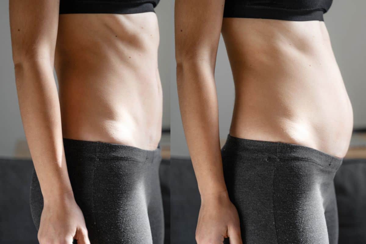 How long does diastasis recti take to improve Westbourne Green?