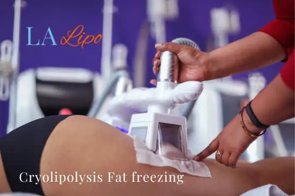 women getting fat freezing Westbourne Green