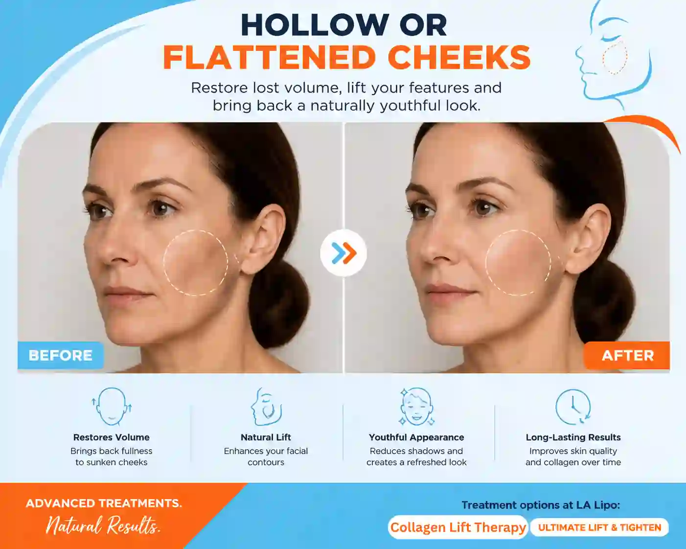 Sign #4: Hollow or Flattened Cheeks Westbourne Green