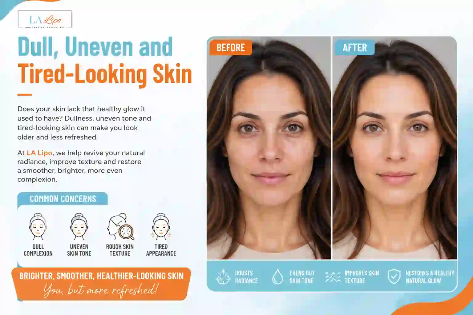 Sign #5: Dull, Uneven and Tired-Looking Skin Westbourne Green