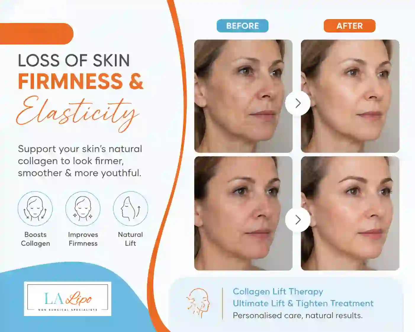 Sign #7: Loss of Skin Firmness and Elasticity Westbourne Green